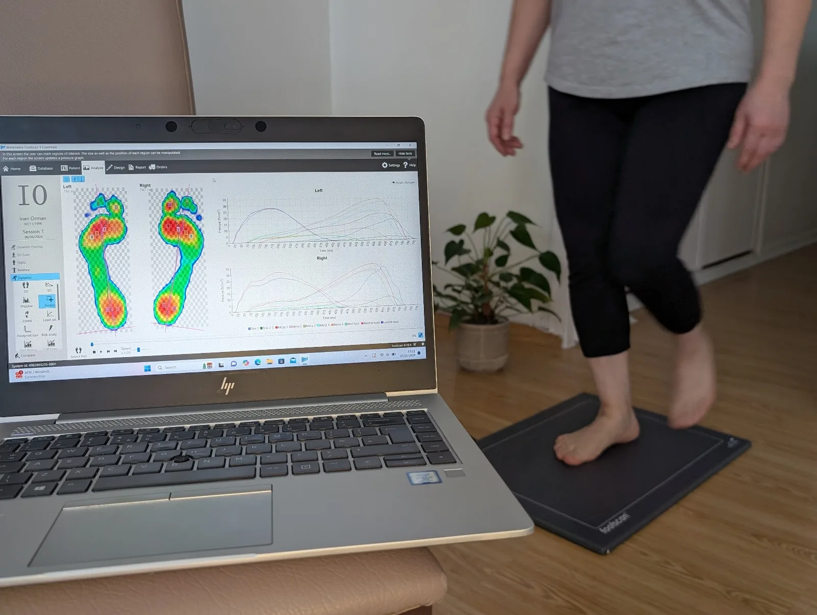 3D foot gait scanner