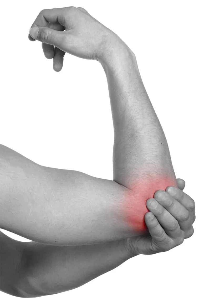 Tennis and golfer's elbow (lateral epicondylitis), one of the conditions treated with focused shockwave therapy at Spine Plus