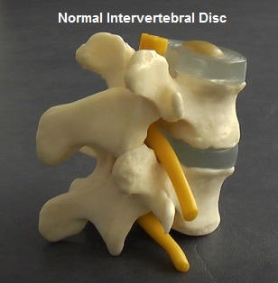 Normal_Vertebra