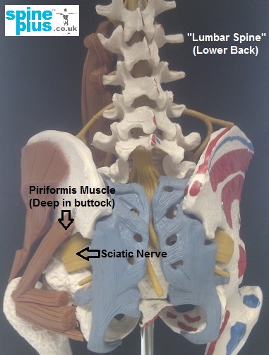 Pelvis_ Piriformis axial stenosis