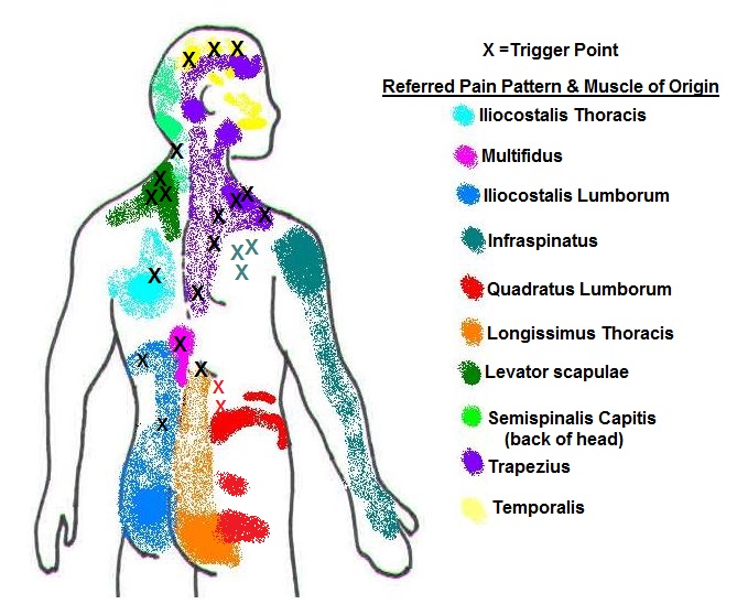 Referred Chart