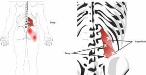 Treatment for Hip Pain (Adductor Tendinopathy, Groin Strain, Femoral Acetabular Impingement, buttock pain, Glute pain, help and advice for hip arthritis, Trochanteric Bursitis) 2