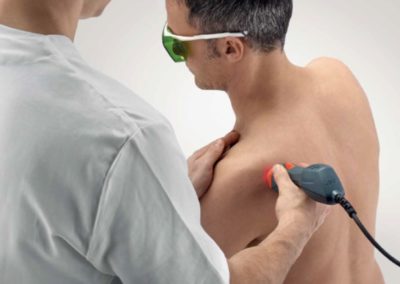 Laser Therapy Class IV for shoulder