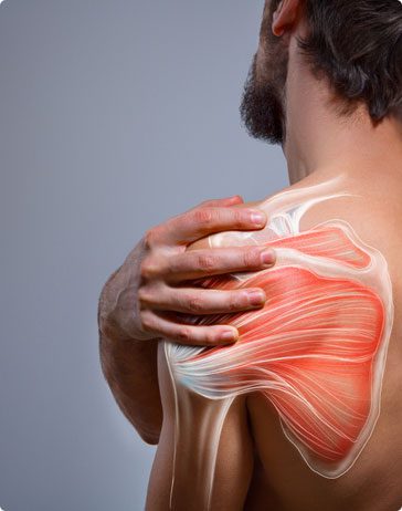 Shoulder Pain treatment Chigwell, Woodford Hornchurch Shoulder Pain treatment Chigwell, Woodford Hornchurch