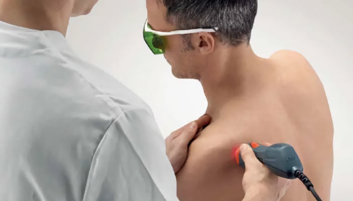 Laser Therapy Class IV for shoulder