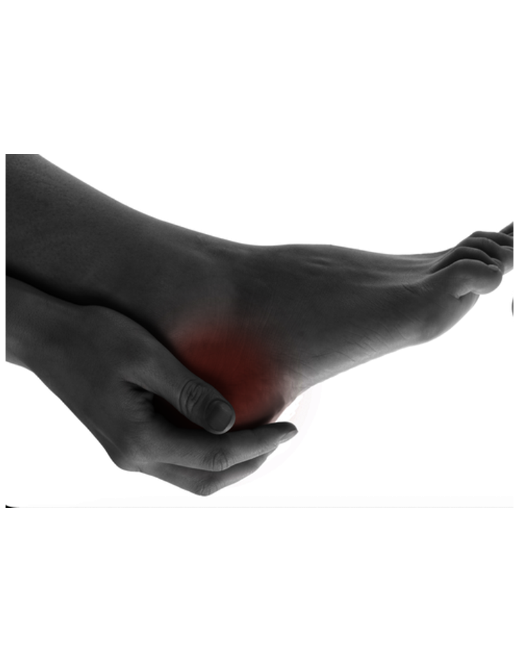 Scoliosis help Essex East London Heel Pain, plantar fasciitis treatment chigwell, woodford, hornchurch, gidea park