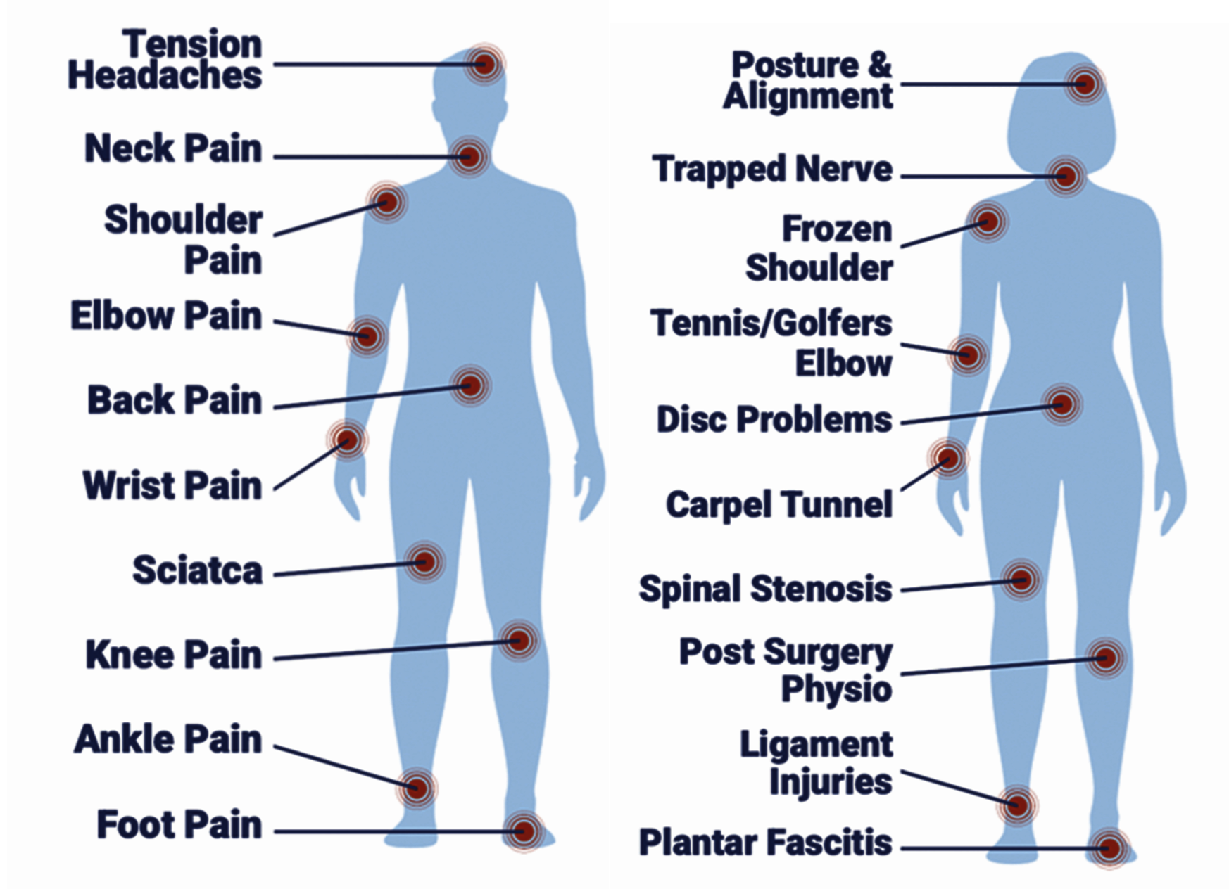 Conditions Diagram List of conditions Physiotherapists and Osteopaths Treat